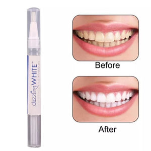 Instant Teeth Whitening Pen (FREE SHIPPING) - Brandable.PK